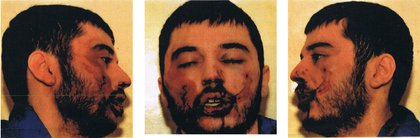 Kevan, after beating by prison officers at HMP Frankland